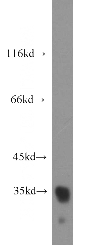 K-562 cells were subjected to SDS PAGE followed by western blot with Catalog No:114678(REDD1 antibody) at dilution of 1:1000