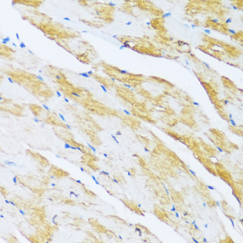 Immunohistochemistry - ARPC1A Polyclonal Antibody 