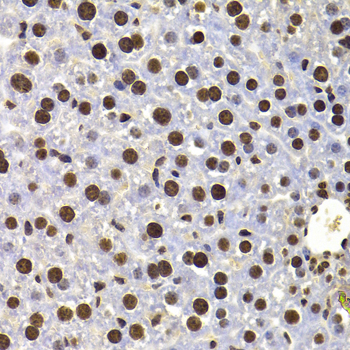 Immunohistochemistry - HIRIP3 Polyclonal Antibody 