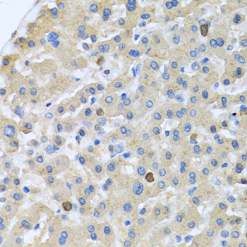 Immunohistochemistry - APOA5 Polyclonal Antibody 