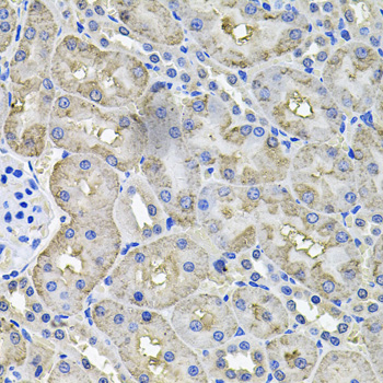 Immunohistochemistry - ACO1 Polyclonal Antibody 