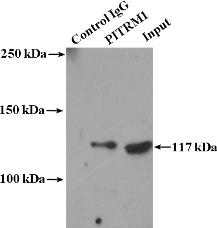 IP Result of anti-PITRM1 (IP:Catalog No:113839, 4ug; Detection:Catalog No:113839 1:500) with A549 cells lysate 2000ug.