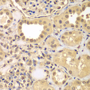 Immunohistochemistry - ARNT2 Polyclonal Antibody 