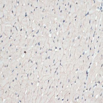 Immunohistochemistry - DMD Polyclonal Antibody 