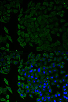 Immunofluorescence - MSLN Polyclonal Antibody 