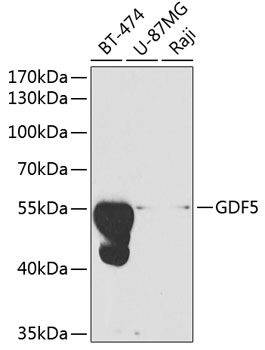 Western blot - GDF5 Polyclonal Antibody 