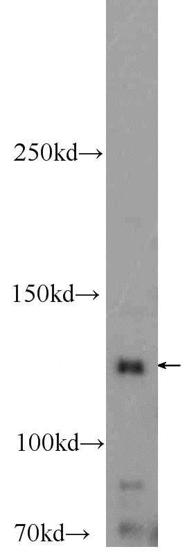 mouse heart tissue were subjected to SDS PAGE followed by western blot with Catalog No:111251(GUCY2F Antibody) at dilution of 1:600