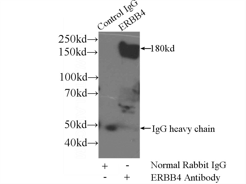 IP Result of anti-ERBB4 (IP:Catalog No:110404, 5ug; Detection:Catalog No:110404 1:1000) with mouse brain tissue lysate 3600ug.