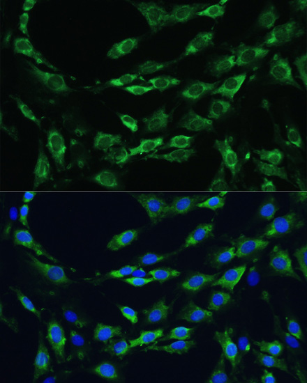 Immunofluorescence - APOB Polyclonal Antibody 
