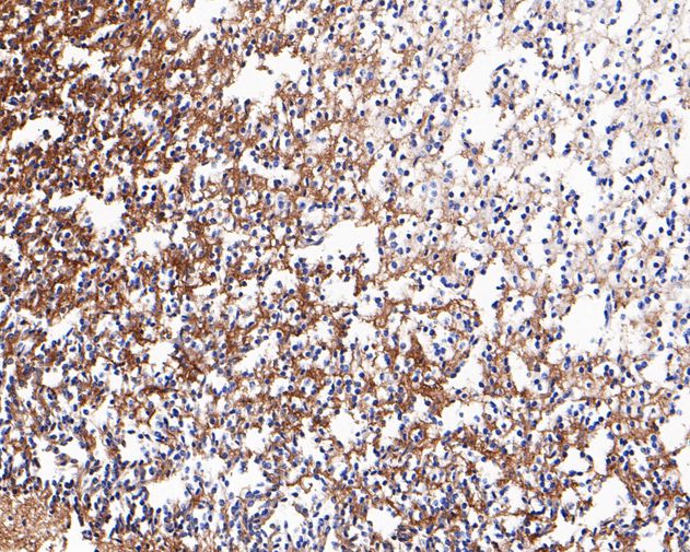 Fig3:; Immunohistochemical analysis of paraffin-embedded human brain tissue using anti-Neurocan antibody. The section was pre-treated using heat mediated antigen retrieval with Tris-EDTA buffer (pH 9.0) for 20 minutes.The tissues were blocked in 5% BSA for 30 minutes at room temperature, washed with ddH; 2; O and PBS, and then probed with the primary antibody ( 1/200) for 30 minutes at room temperature. The detection was performed using an HRP conjugated compact polymer system. DAB was used as the chromogen. Tissues were counterstained with hematoxylin and mounted with DPX.