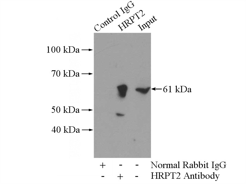 IP Result of anti-HRPT2; CDC73 (IP:Catalog No:111466, 4ug; Detection:Catalog No:111466 1:500) with mouse testis tissue lysate 4000ug.