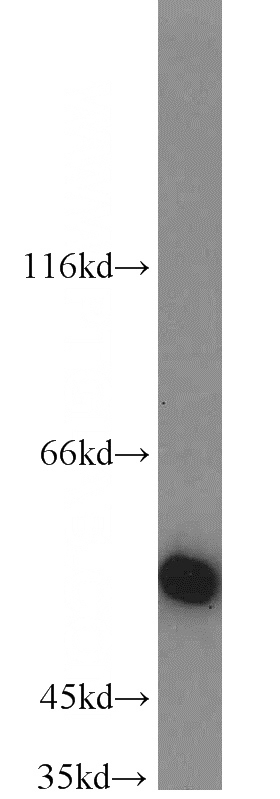 mouse liver tissue were subjected to SDS PAGE followed by western blot with Catalog No:111847(INSC antibody) at dilution of 1:1000