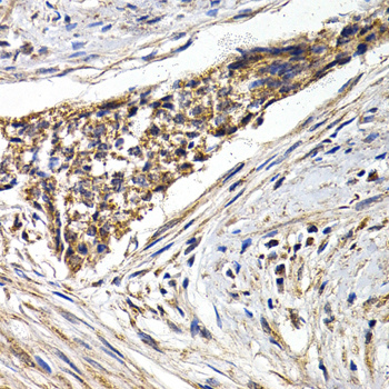 Immunohistochemistry - FZR1 Polyclonal Antibody 