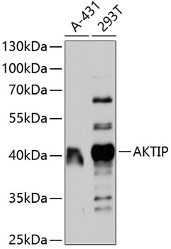Western blot - AKTIP Polyclonal Antibody 