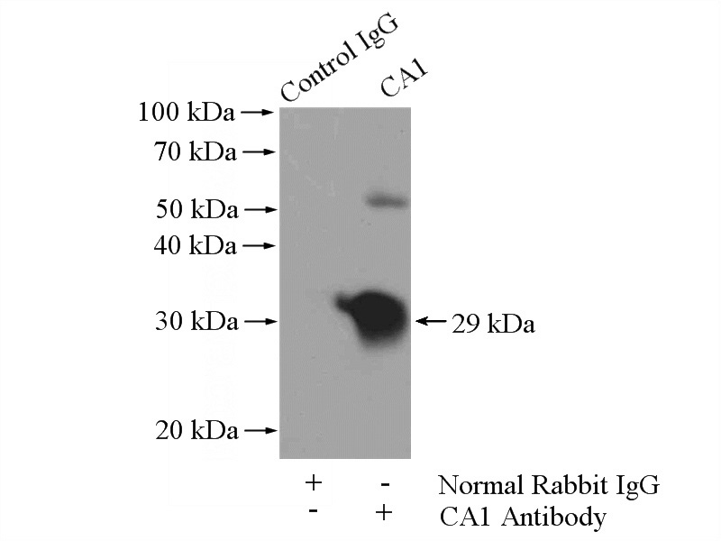 IP Result of anti-CA1 (IP:Catalog No:108741, 4ug; Detection:Catalog No:108741 1:500) with K-562 cells lysate 1200ug.