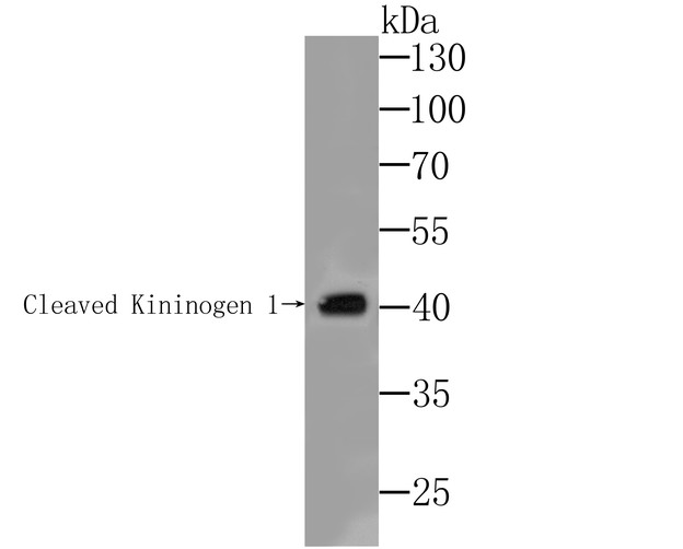 Fig1: Western blot analysis of Kininogen 1 on mouse stomach lysate. Proteins were transferred to a PVDF membrane and blocked with 5% BSA in PBS for 1 hour at room temperature. The primary antibody was used at a 1:500 dilution in 5% BSA at room temperature for 2 hours. Goat Anti-Rabbit IgG - HRP Secondary Antibody (HA1001) at 1:5,000 dilution was used for 1 hour at room temperature.