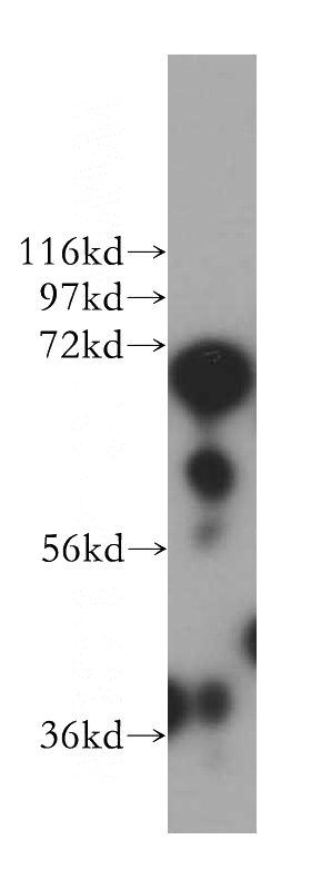 HeLa cells were subjected to SDS PAGE followed by western blot with Catalog No:112519(METTL4 antibody) at dilution of 1:500