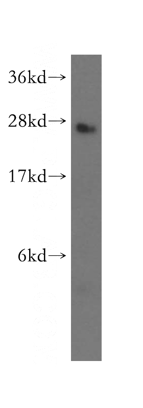 mouse lung tissue were subjected to SDS PAGE followed by western blot with Catalog No:109761(DCTN6 antibody) at dilution of 1:500