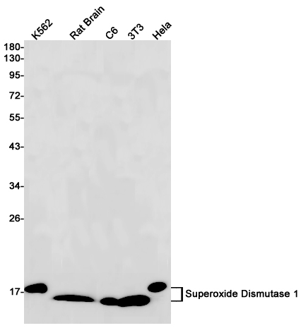 Western blot detection of Superoxide Dismutase 1 in K562,Rat Brain,C6,3T3,Hela cell lysates using Superoxide Dismutase 1 Rabbit pAb(1:1000 diluted).Predicted band size:16kDa.Observed band size:18kDa.