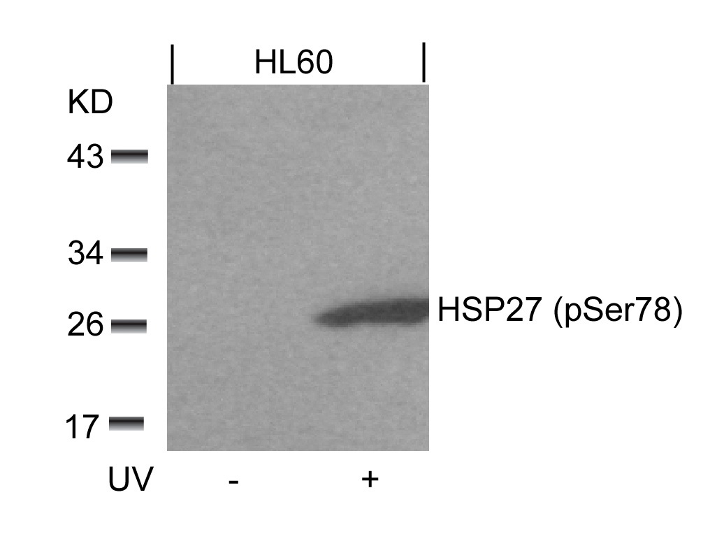 Western blot analysis of extracts from HL60 cells untreated or treated with UV using HSP27 (Phospho-Ser78) Antibody .