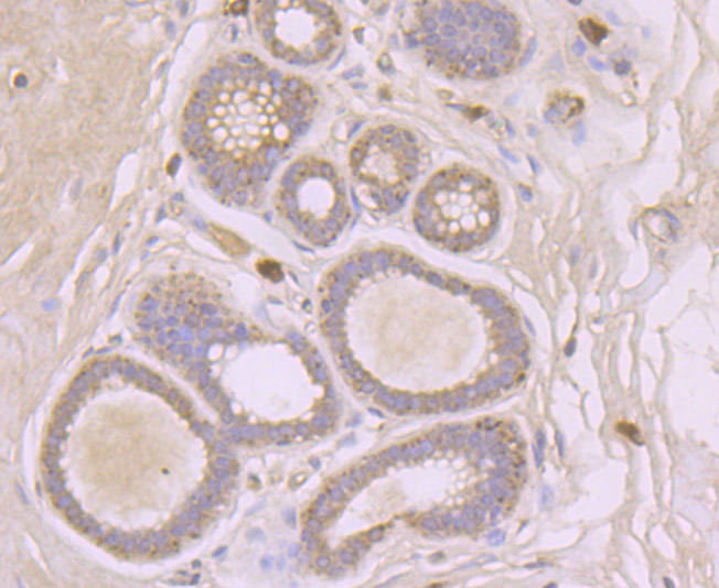 Fig6: Immunohistochemical analysis of paraffin-embedded human breast tissue using anti-SFRP1 antibody. Counter stained with hematoxylin.