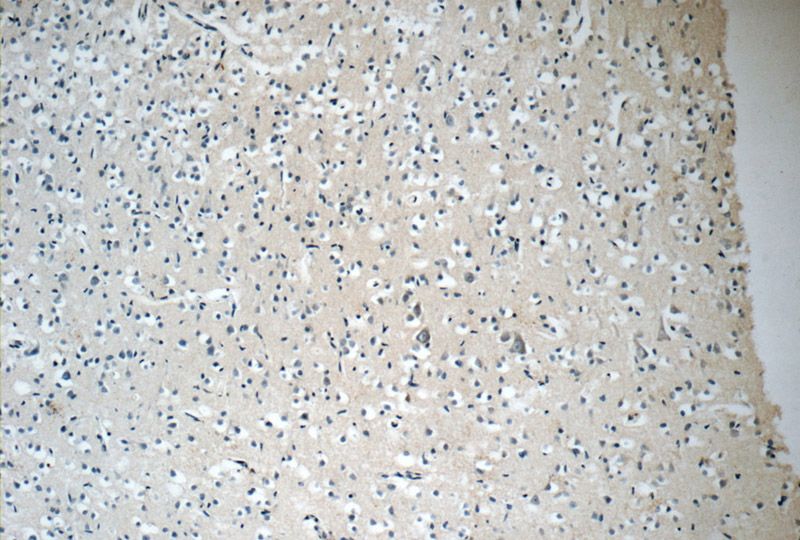 Immunohistochemistry of paraffin-embedded human brain tissue slide using Catalog No:108186(ARHGEF4 Antibody) at dilution of 1:50 (under 10x lens)