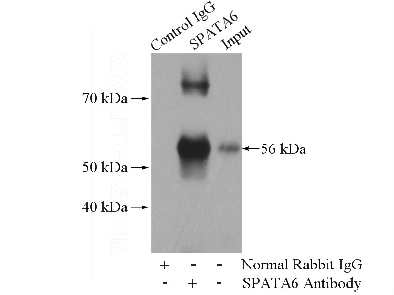 IP Result of anti-SPATA6 (IP:Catalog No:115554, 4ug; Detection:Catalog No:115554 1:800) with mouse testis tissue lysate 4000ug.
