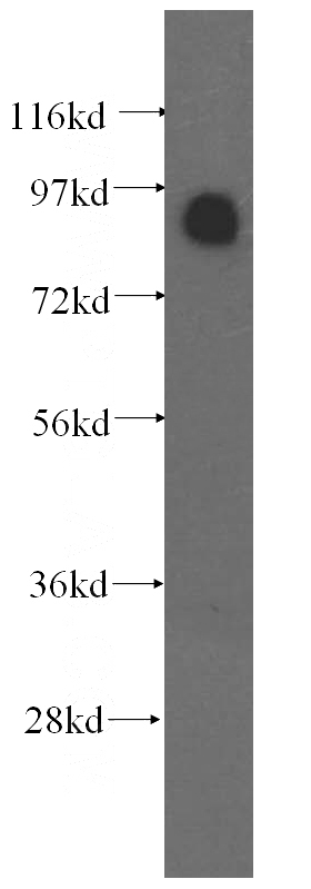 HeLa cells were subjected to SDS PAGE followed by western blot with Catalog No:113428(OSBP antibody) at dilution of 1:800