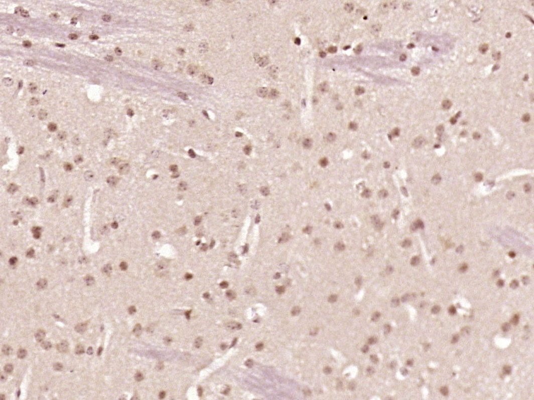 Fig3: Paraformaldehyde-fixed, paraffin embedded (Mouse brain); Antigen retrieval by boiling in sodium citrate buffer (pH6.0) for 15min; Block endogenous peroxidase by 3% hydrogen peroxide for 20 minutes; Blocking buffer (normal goat serum) at 37℃ for 30min; Antibody incubation with (ZNF312) Polyclonal Antibody, Unconjugated at 1:500 overnight at 4℃, followed by a conjugated secondary (sp-0023) for 20 minutes and DAB staining.