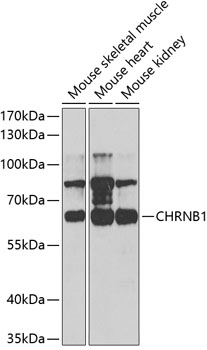 Western blot - CHRNB1 Polyclonal Antibody 