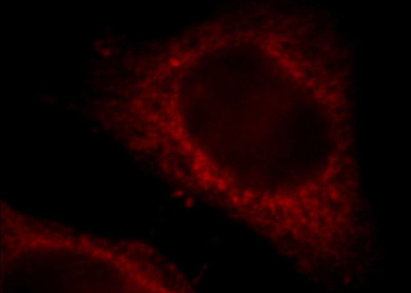 Immunofluorescent analysis of Hela cells, using KTN1 antibody Catalog No:112253 at 1:25 dilution and Rhodamine-labeled goat anti-rabbit IgG (red).