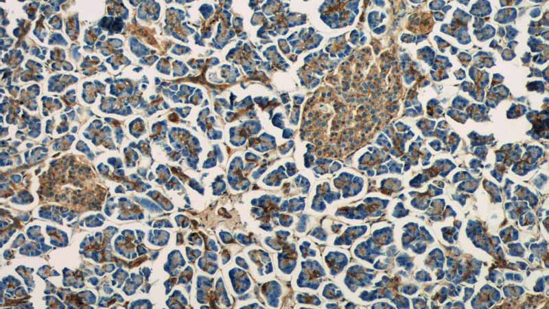 Immunohistochemistry of paraffin-embedded human pancreas tissue slide using Catalog No:108098(ANXA7 Antibody) at dilution of 1:50 (under 10x lens)