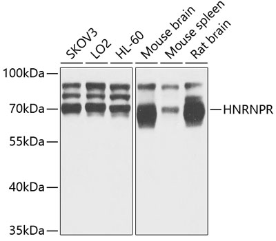 Western blot - HNRNPR Polyclonal Antibody 