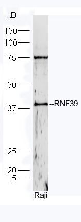 Fig1: Protein: Raji lysate at 40ug;; Primary: rabbit Anti-RNF39 at 1:300;; Secondary: HRP conjugated Goat-Anti-rabbit IgG(bs-0295G-HRP) at 1: 5000;; Predicted band size: 38/45 kD; Observed band size: 38 kD