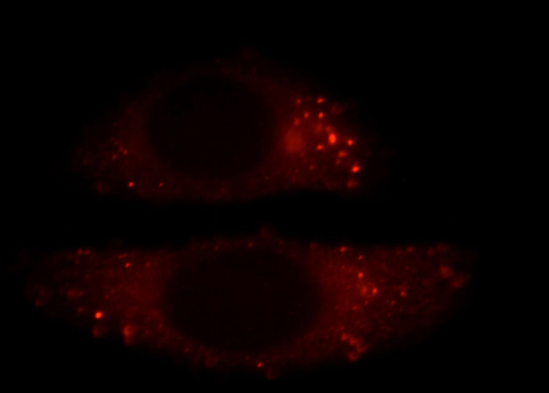 Immunofluorescent analysis of HepG2 cells, using FLNB antibody Catalog No:110690 at 1:25 dilution and Rhodamine-labeled goat anti-rabbit IgG (red).