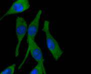 Fig3:; ICC staining of PPP1R1A in SH-SY5Y cells (green). Formalin fixed cells were permeabilized with 0.1% Triton X-100 in TBS for 10 minutes at room temperature and blocked with 10% negative goat serum for 15 minutes at room temperature. Cells were probed with the primary antibody ( 1/50) for 1 hour at room temperature, washed with PBS. Alexa Fluor®488 conjugate-Goat anti-Rabbit IgG was used as the secondary antibody at 1/1,000 dilution. The nuclear counter stain is DAPI (blue).