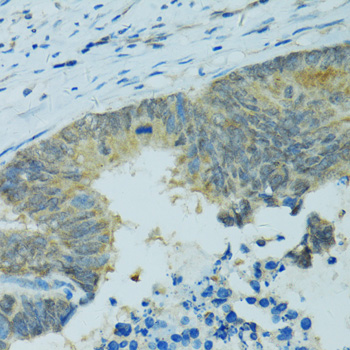 Immunohistochemistry - CYP2B6 Polyclonal Antibody 