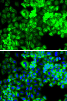 Immunofluorescence - SARS Polyclonal Antibody 