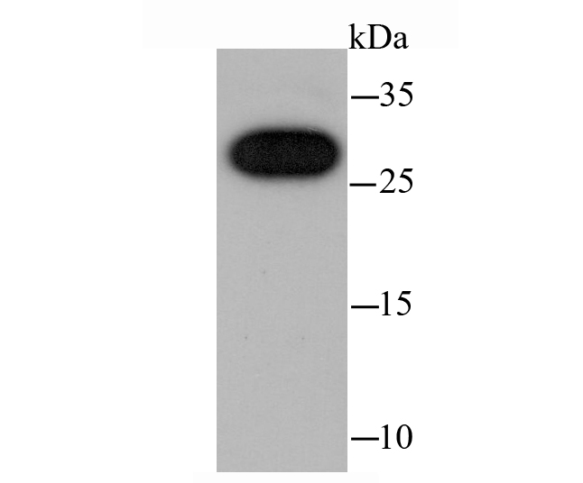 Fig1:; Western blot analysis of cbx7 on A431 cell lysates. Proteins were transferred to a PVDF membrane and blocked with 5% BSA in PBS for 1 hour at room temperature. The primary antibody ( 1/500) was used in 5% BSA at room temperature for 2 hours. Goat Anti-Rabbit IgG - HRP Secondary Antibody (HA1001) at 1:200,000 dilution was used for 1 hour at room temperature.