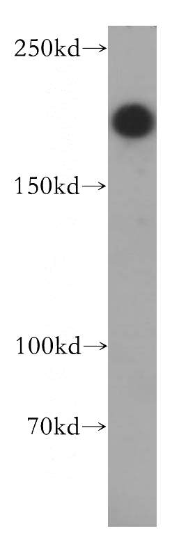 SH-SY5Y cells were subjected to SDS PAGE followed by western blot with Catalog No:112965(NBAS antibody) at dilution of 1:500