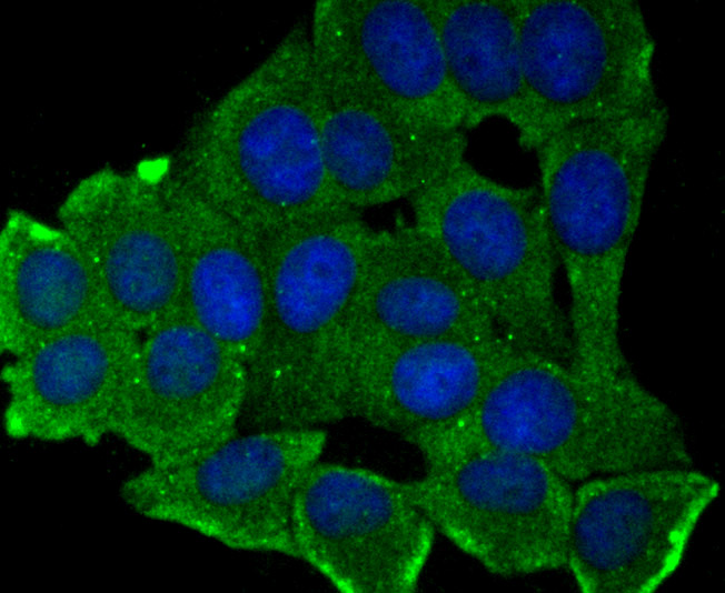 Fig2: ICC staining MMP17 in MCF-7 cells (green). The nuclear counter stain is DAPI (blue). Cells were fixed in paraformaldehyde, permeabilised with 0.25% Triton X100/PBS.
