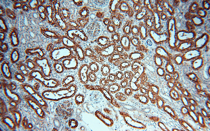 Immunohistochemical of paraffin-embedded human kidney using Catalog No:108045(AQP1 antibody) at dilution of 1:100 (under 10x lens)