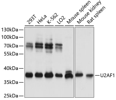 Western blot - U2AF1 Polyclonal Antibody 