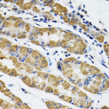 Immunohistochemistry - HAPLN1 Polyclonal Antibody 