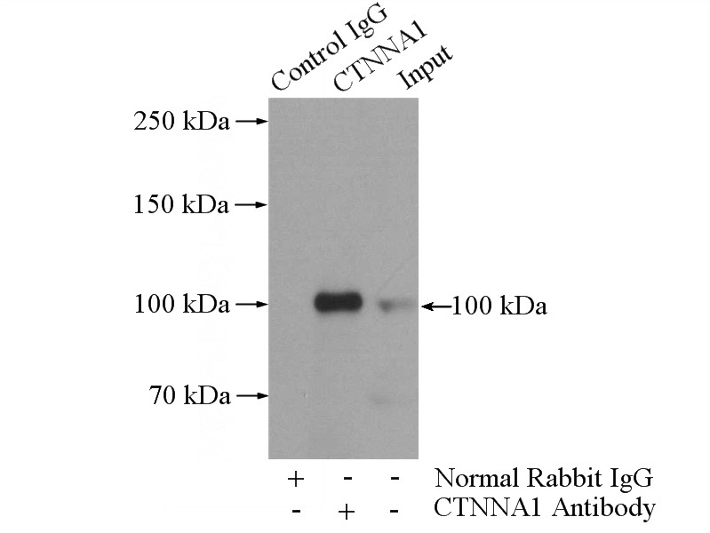 IP Result of anti-CTNNA1 (IP:Catalog No:107869, 4ug; Detection:Catalog No:107869 1:700) with mouse brain tissue lysate 4000ug.