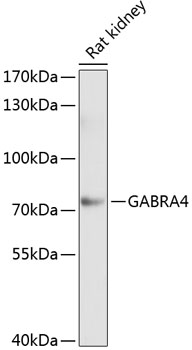 Western blot - GABRA4 Polyclonal Antibody 