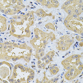 Immunohistochemistry - SPTLC1 Polyclonal Antibody 
