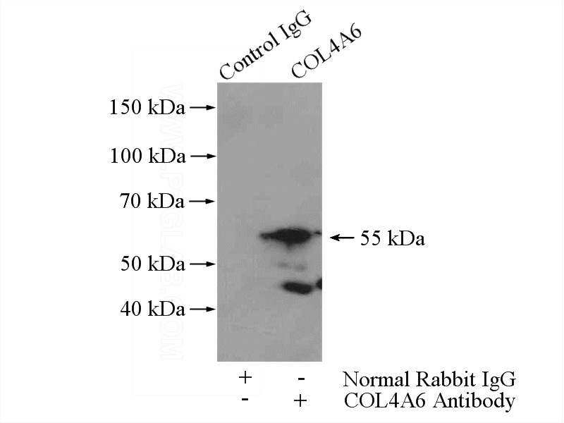 IP Result of anti-COL4A6 (IP:Catalog No:109381, 4ug; Detection:Catalog No:109381 1:300) with mouse skeletal muscle tissue lysate 3600ug.