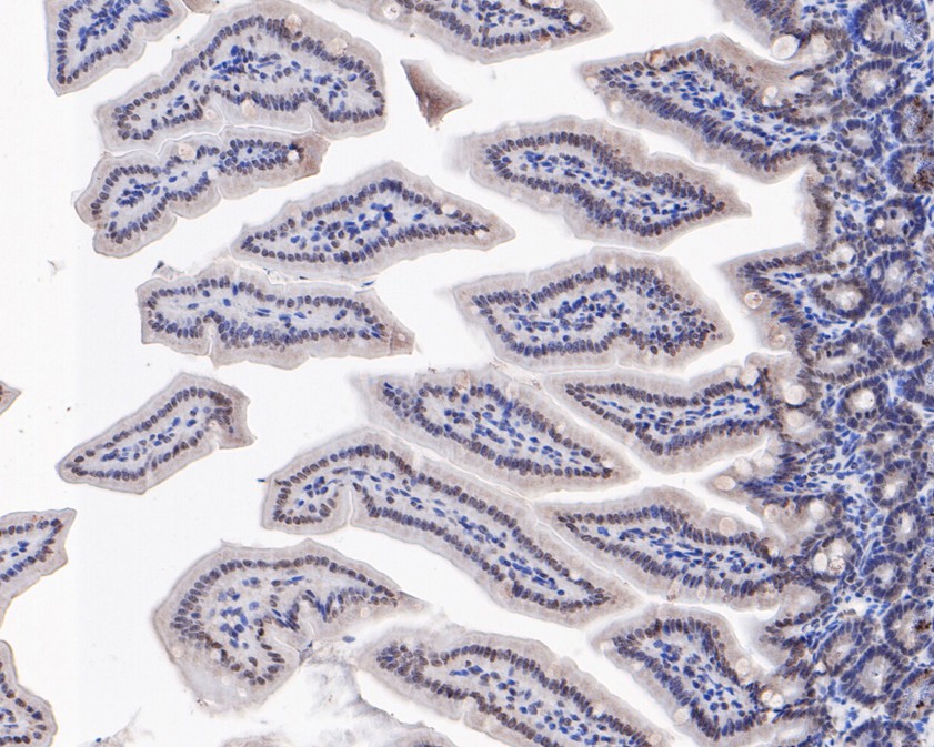 Fig2:; Immunohistochemical analysis of paraffin-embedded mouse colon tissue using anti-FAM13C antibody. The section was pre-treated using heat mediated antigen retrieval with sodium citrate buffer (pH 6.0) for 20 minutes. The tissues were blocked in 5% BSA for 30 minutes at room temperature, washed with ddH; 2; O and PBS, and then probed with the primary antibody ( 1/400) for 30 minutes at room temperature. The detection was performed using an HRP conjugated compact polymer system. DAB was used as the chromogen. Tissues were counterstained with hematoxylin and mounted with DPX.