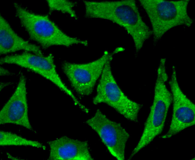 Fig2: ICC staining SFRP1 in SH-SY-5Y cells (green). The nuclear counter stain is DAPI (blue). Cells were fixed in paraformaldehyde, permeabilised with 0.25% Triton X100/PBS.